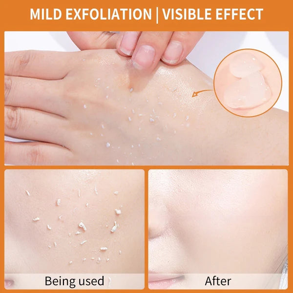 Protones™ Orange Enzyme Exfoliating Gel